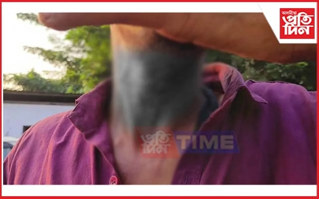 মহানগৰীত ব্লেডেৰে ডিঙি কাটি ট্ৰাক চালকক হত্যাৰ চেষ্টা
