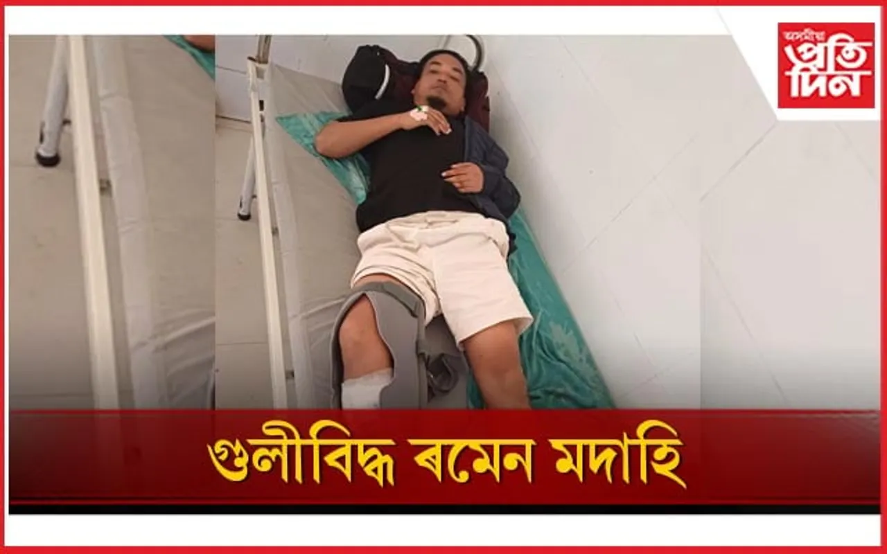 গুলীবিদ্ধ ভূ-মাফিয়া ৰমেন মদাহি...