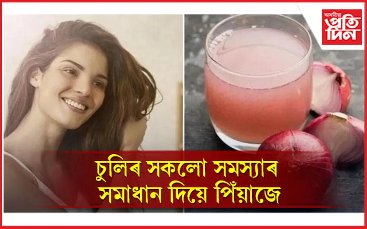 চুলিত কিদৰে পিঁয়াজ ব্যৱহাৰ কৰিব লাগে জানি লওঁক