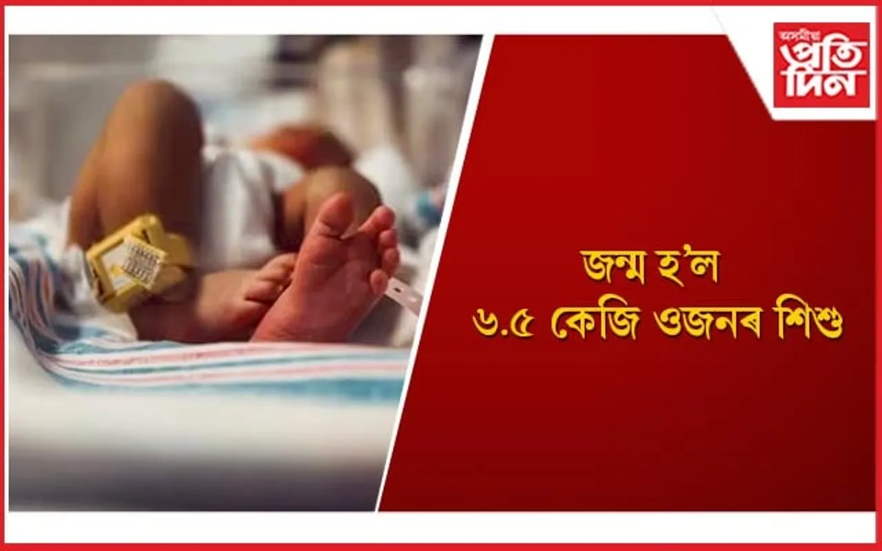 চিকিৎসালয়ত জন্ম হোৱা সবোতোকৈ অধিক ওজনৰ শিশু হিচাপে গঢ়িলে অভিলেখ
