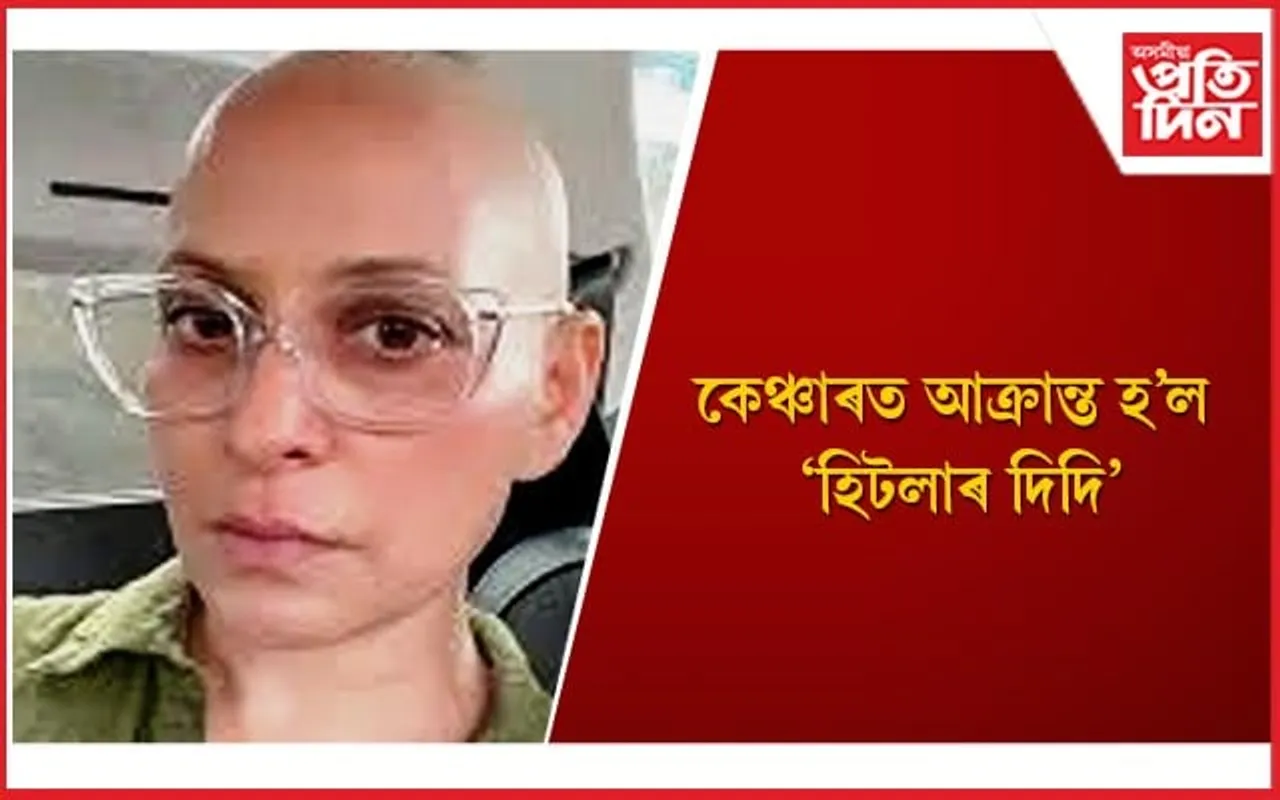 গ্ৰীৱাৰ কৰ্কট ৰোগ কি, ইয়াৰ লক্ষণবোৰৰ বিষয়ে আপুনিও জানি লওঁক