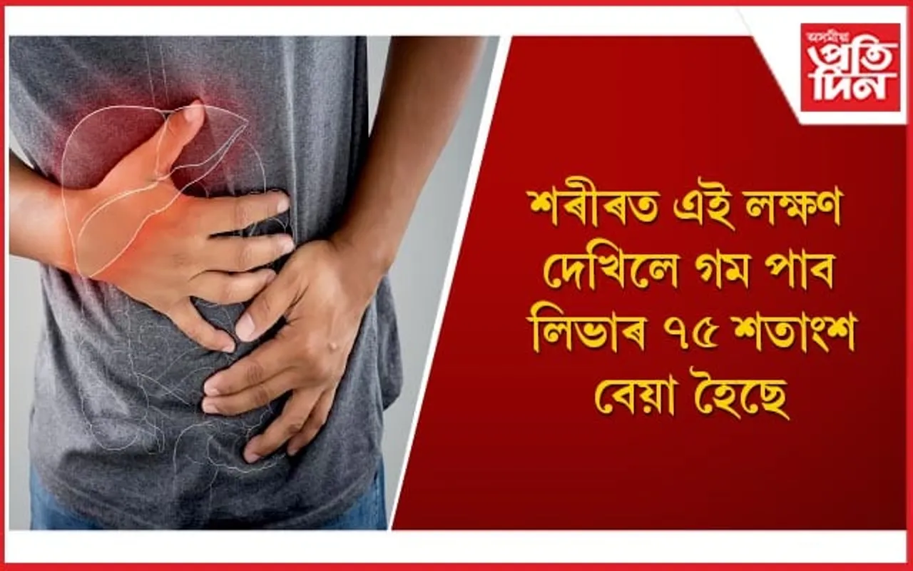 সাৱধান হওঁক ! ফেটি লিভাৰ ধৰা পৰালৈকে লিভাৰৰ অৱস্থা হয় শোচনীয় 