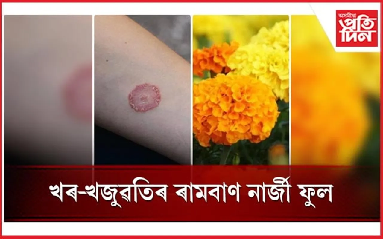 নাৰ্জী ফুলৰ ঔষধি গুণৰ বিষয়ে জানেনে ?