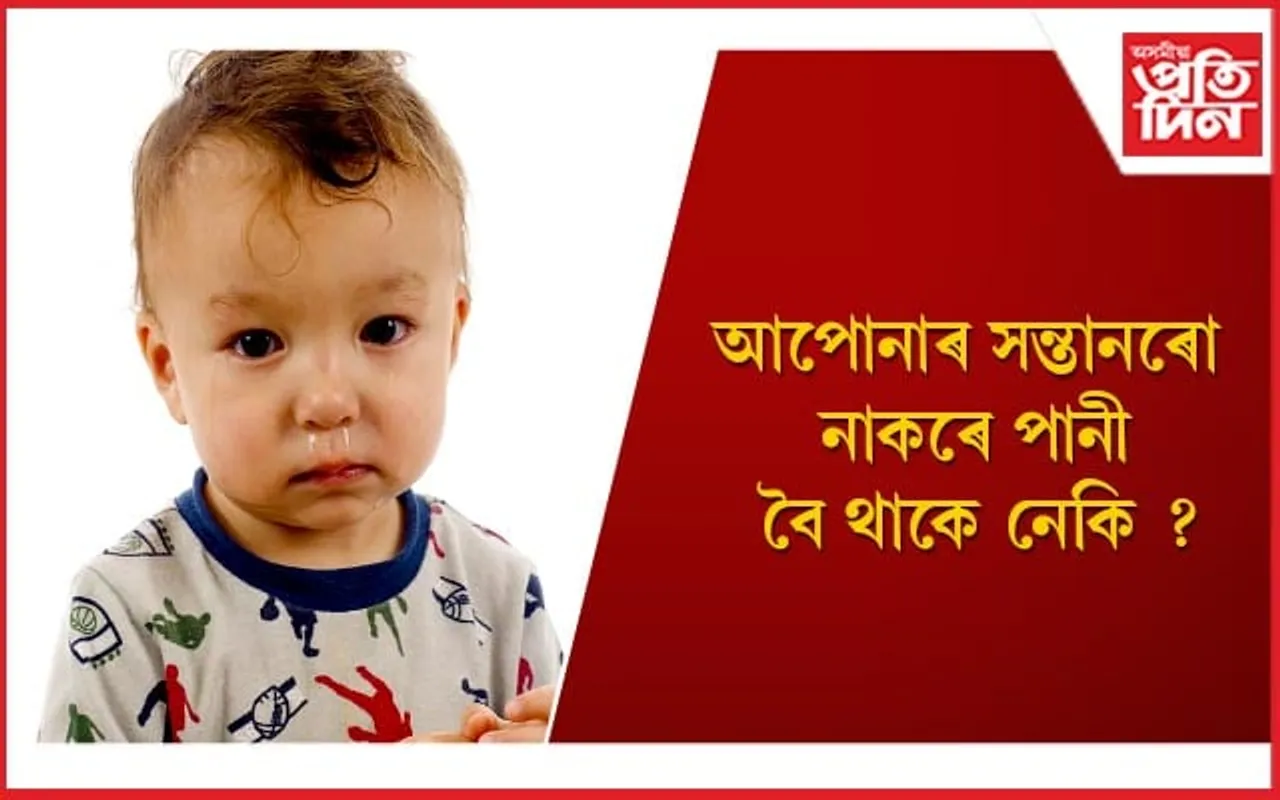 ঠাণ্ডা দিনত শিশুৰ নাকৰ সমস্যাৰ পৰা সমাধান পোৱাৰ সহজ উপায়কেইটা জানি লওঁক