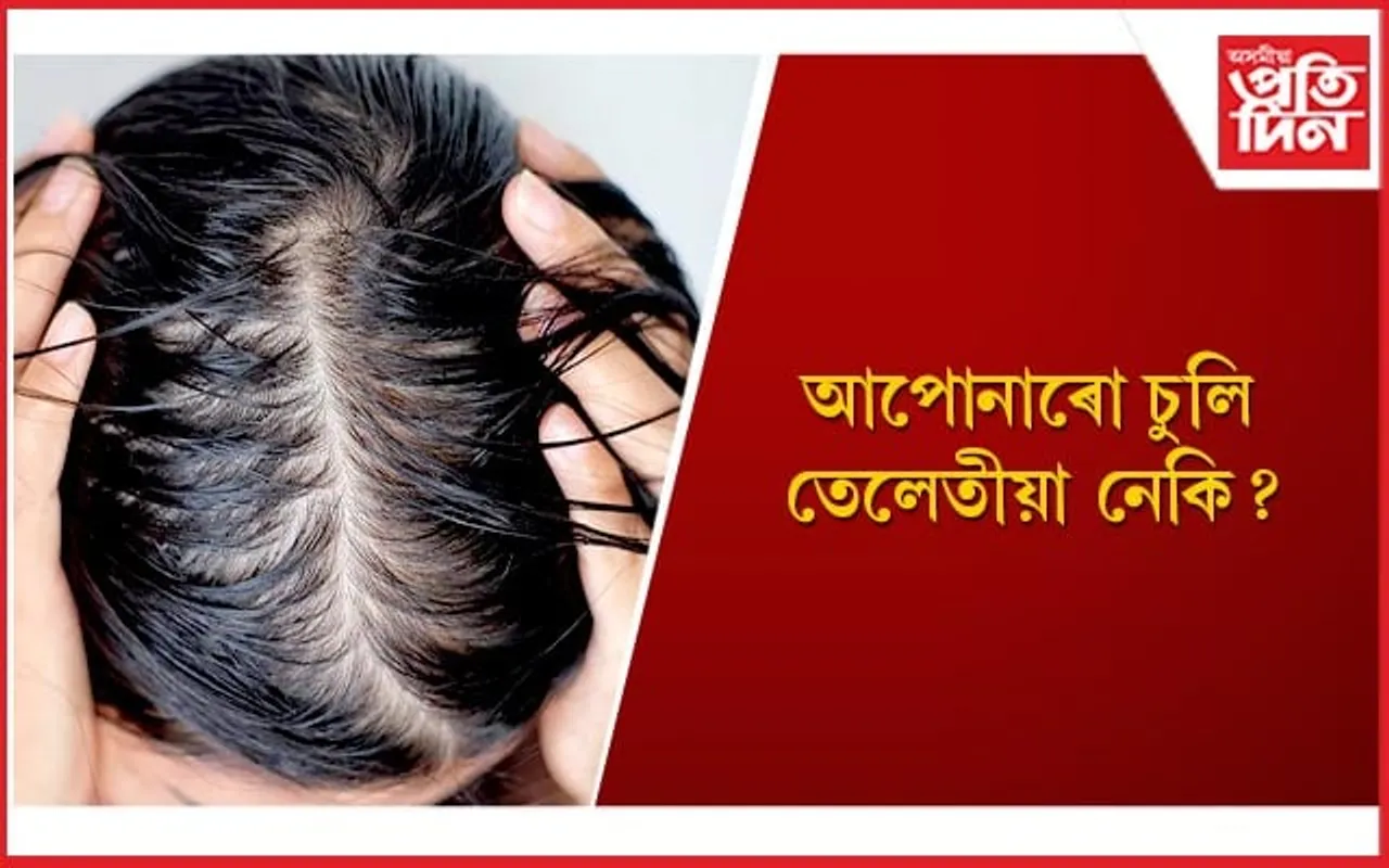 মাত্ৰ চাৰিটা উপায়ৰে তেলেতীয়া চুলিৰ সমস্যাৰ পৰা পৰিত্ৰাণ পাওঁক