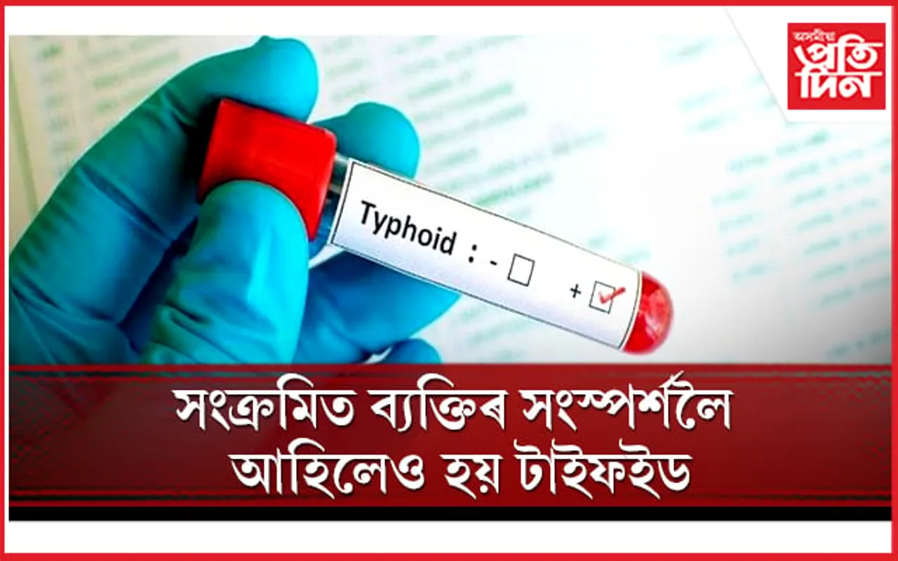 টাইফইডৰ লক্ষণ, ঘৰুৱা প্ৰতিকাৰৰ বিষয়ে জানি লৈ সাৱধান হওঁক