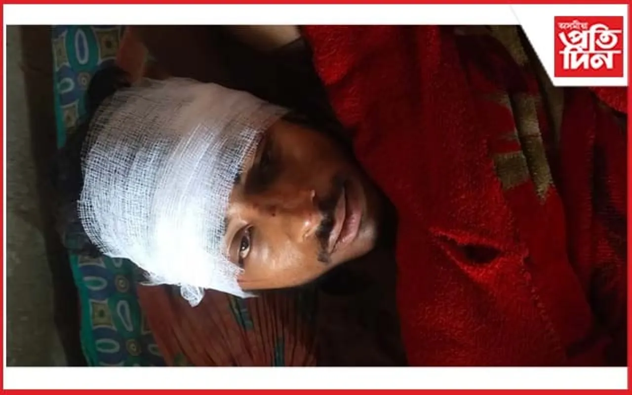 কোকৰাঝাৰত যুৱকক আক্ৰমণঃ গুৰুতৰভাৱে আহত...