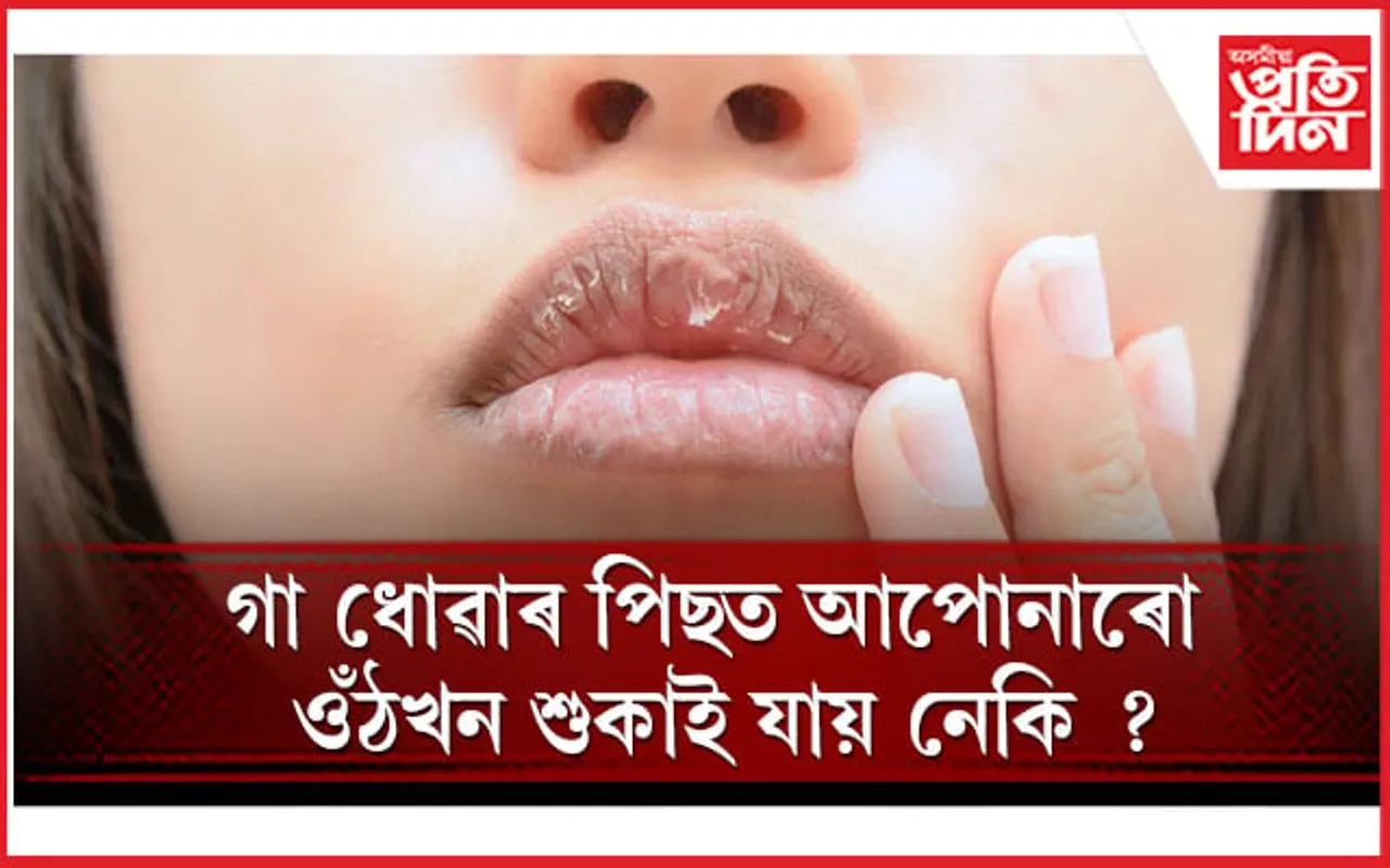 এইদৰে কৰক ওঁঠৰ সকলো সমস্যাৰ সমাধান
