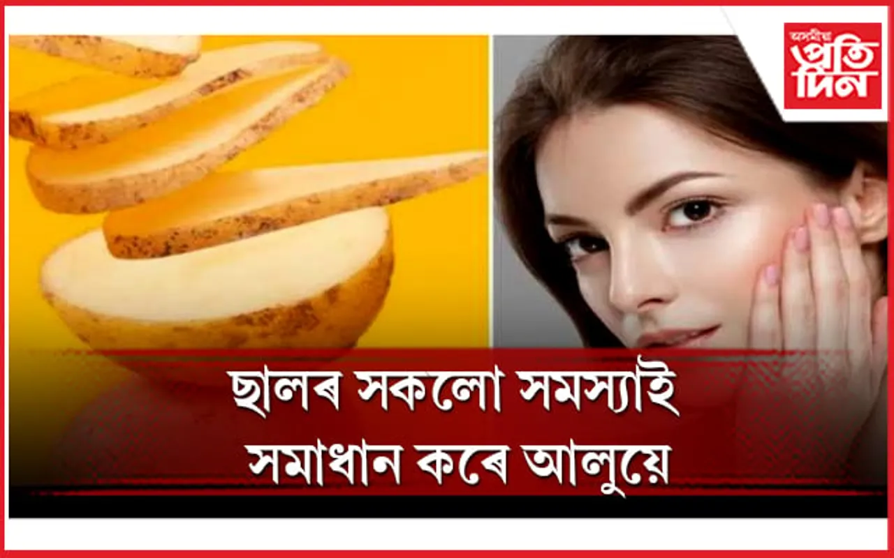 বহু গুণৰে সমৃদ্ধ আলু, আপুনিও জানি লওঁক