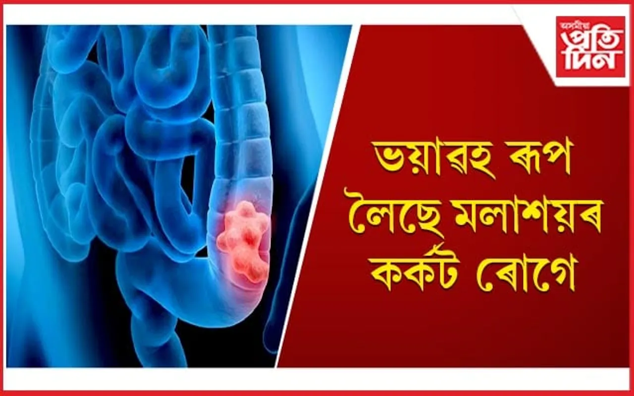 এই ৰোগত মহিলাতকৈ অধিক হাৰত আক্ৰান্ত হয় পুৰুষ