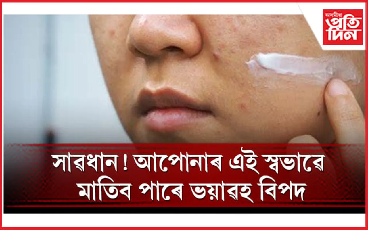 শালমইনা আঁতৰাবলৈ আপুনিও ক্ৰীম ঘঁহে নেকি ?