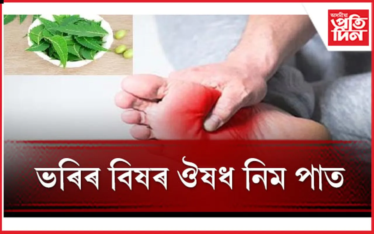 ভৰিৰ বিষে জ্বলা-কলা খুৱাইছে যদি এইসমূহ ঘৰুৱা প্ৰতিকাৰ ব্যৱহাৰ কৰক