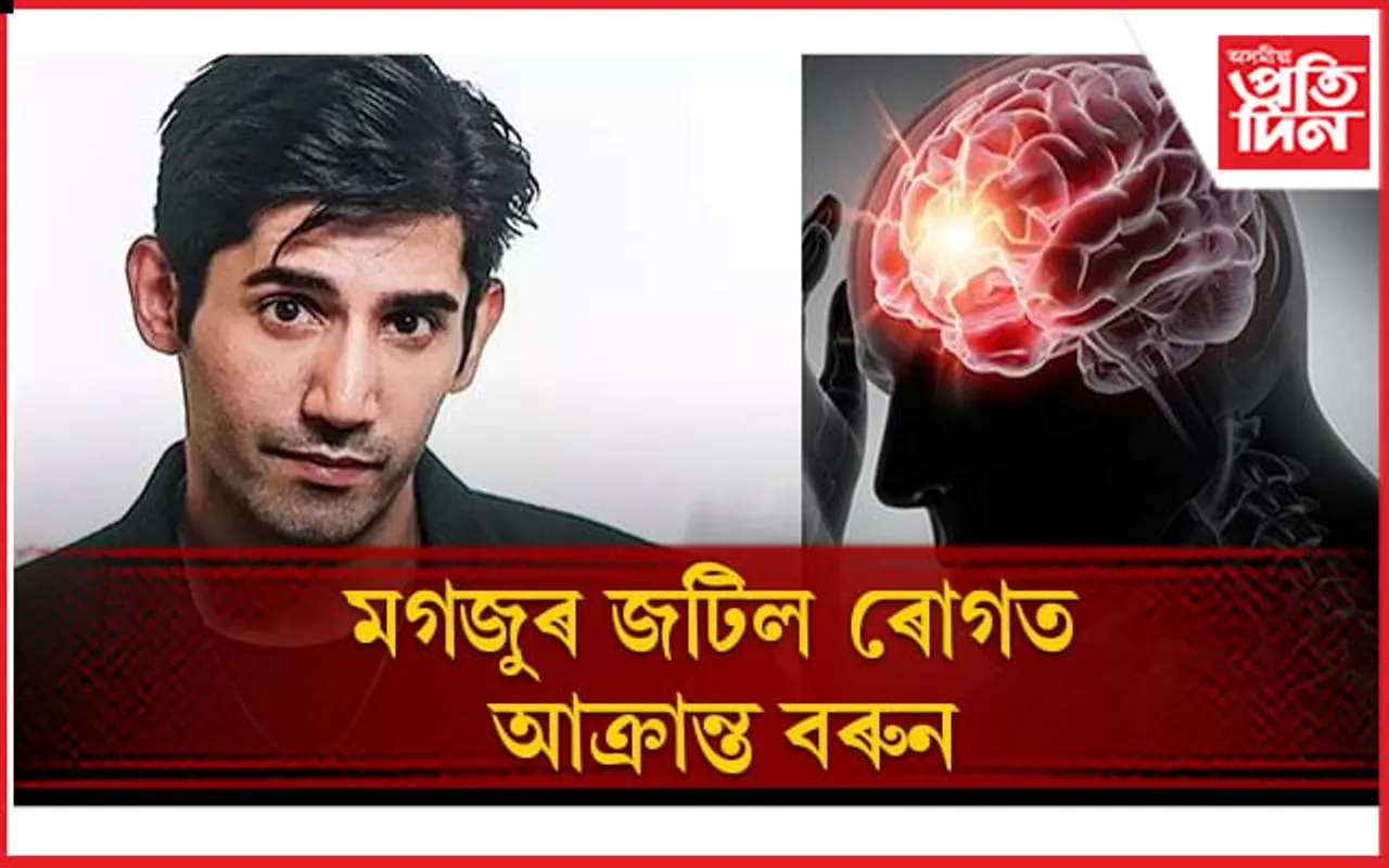 মূৰত আঘাত পালে সহজভাৱে নল'ব, অন্যথা ভূগিব পাৰে গুৰুতৰ ৰোগত