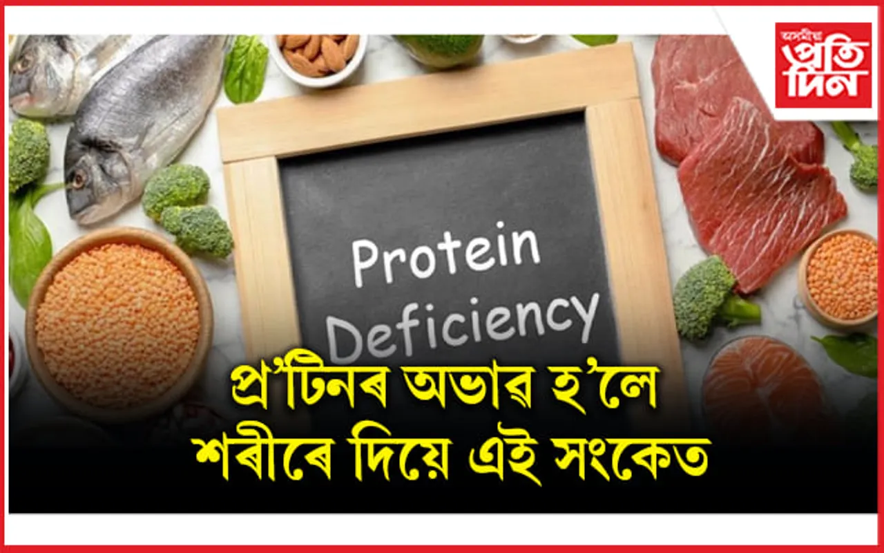 শৰীৰক পৰ্যাপ্ত প্ৰটিন যোগানৰ বাবে কি খাব লাগে জানি লওঁক