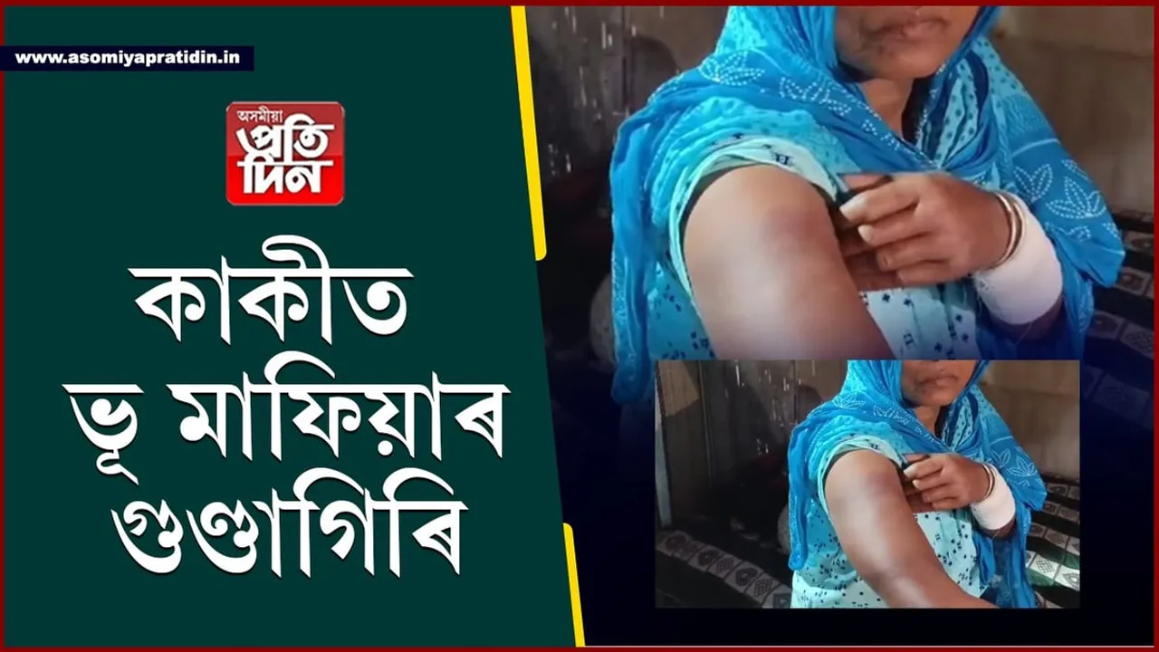 লংকাৰ কাকীত ভূ মাফিয়াৰ তাণ্ডৱ, বয়োজ্যেষ্ঠ মহিলাকো কৰিলে আক্ৰমণ...