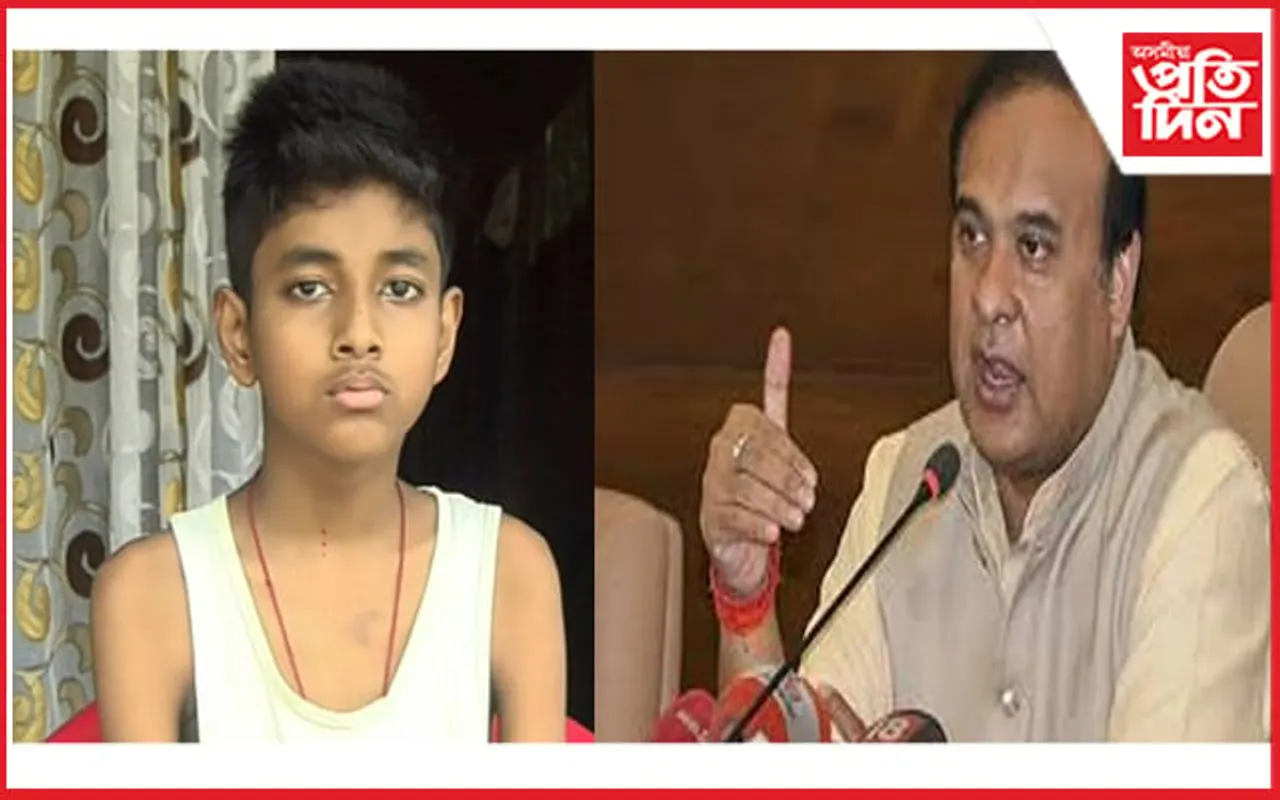 জটিল ৰোগত আক্ৰান্ত ছাত্ৰৰ চিকিৎসাৰ সমস্ত দায়িত্ব গ্ৰহণ মুখ্যমন্ত্ৰীৰ
