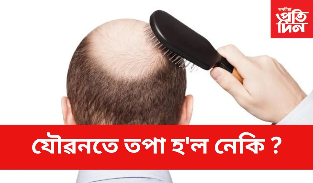 এই গুৰুতৰ সমস্যাৰ পৰা বাচি তথাৰ উপায়কেইটা জানি লওঁক