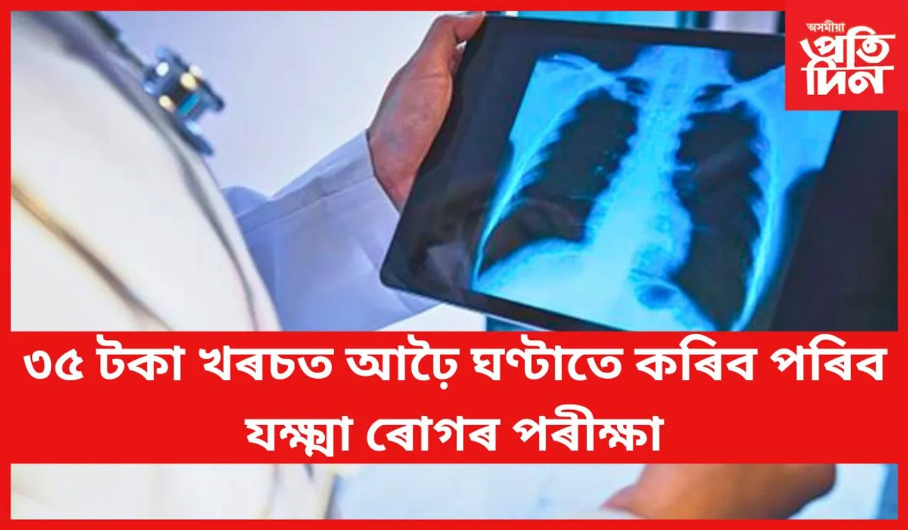 ২০২৫ত যক্ষ্মা মুক্ত হ’ব ভাৰতবৰ্ষ !
