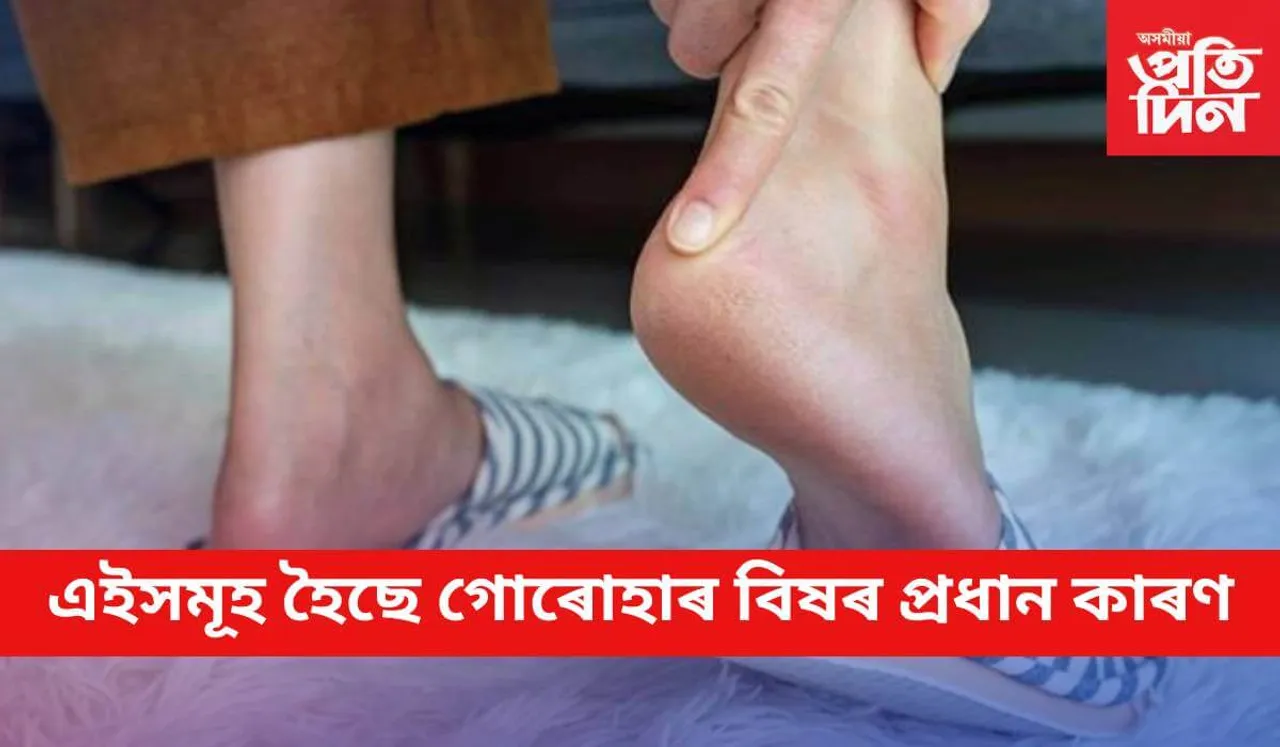 কেতবোৰ বিশেষ দিশত সৰ্তক হ’লেই কেতিয়াও নহয় গোৰোহাৰ বিষ