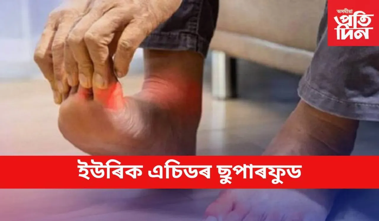এই গুৰুতৰ ৰোগৰ ঔষধ আছে পাকঘৰত
