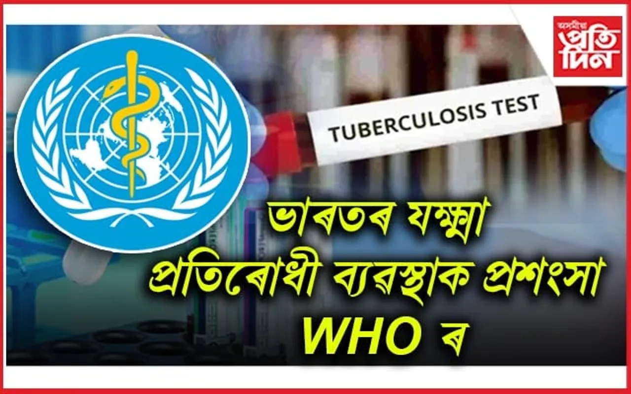 ভাৰতৰ যক্ষ্মা প্ৰতিৰোধী ব্যৱস্থাক প্ৰশংসা WHOৰঃ বিশ্বত ৮ শতাংশ, ভাৰতত ১৮ শতাংশ ৰোগী হ্ৰাস...