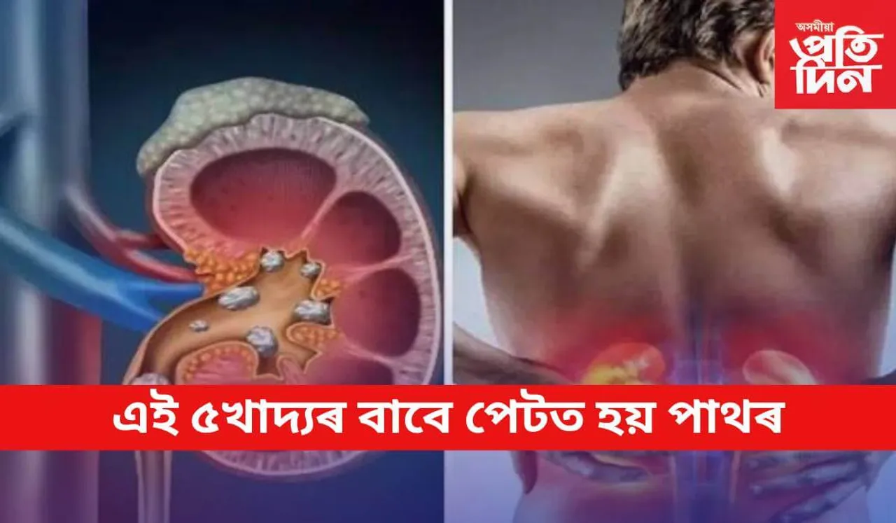 আজিৰে পৰা এইবোৰ খাদ্য নাখাব