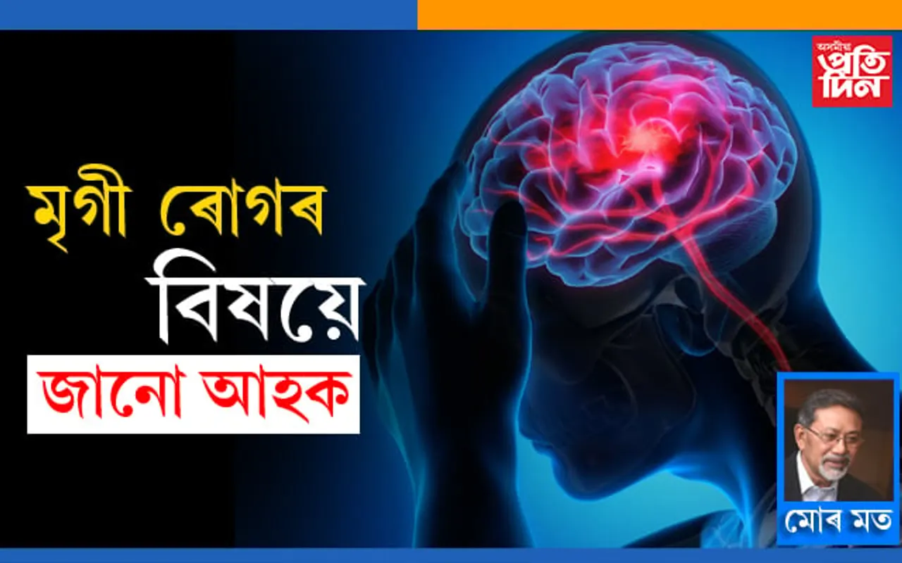 মৃগী দুৰাৰোগ্য নহয়…