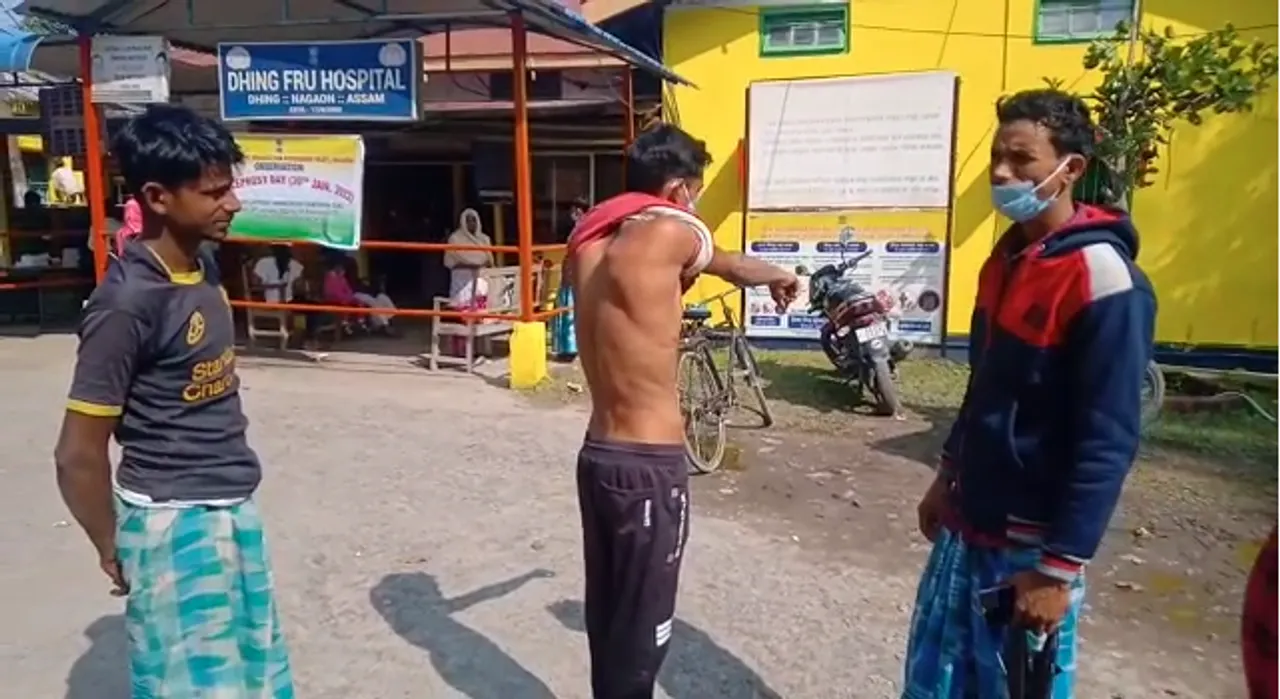 ধিঙৰ চৰ চাপৰি অঞ্চলত মাতাব্বৰৰ আক্ৰমনত গুৰুতৰভাৱে আহত দুজন
