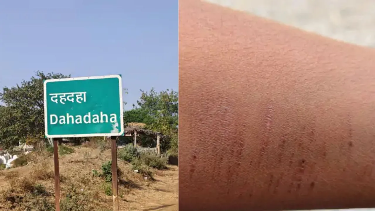 Dhamtari Students Hand Cutting Incident