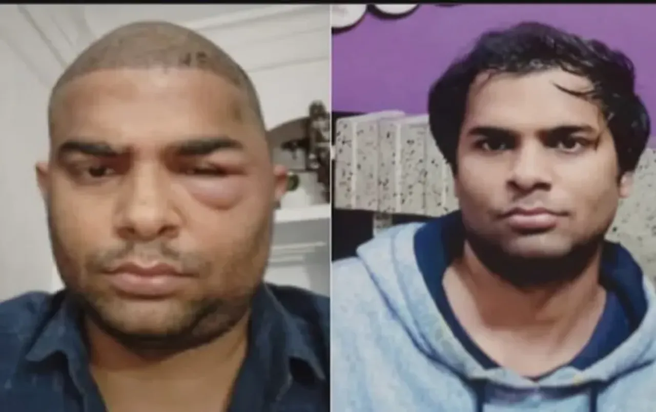 Kanpur Hair Transplant Case: दांतों की डॉक्टर ने 40 हजार में किए थे हेयर ट्रांसप्लांट, ये काम करने का किया था दावा