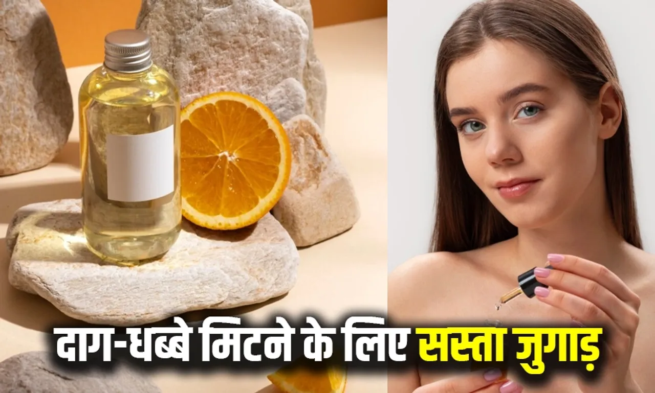 Homemade Spots Removing Remedies