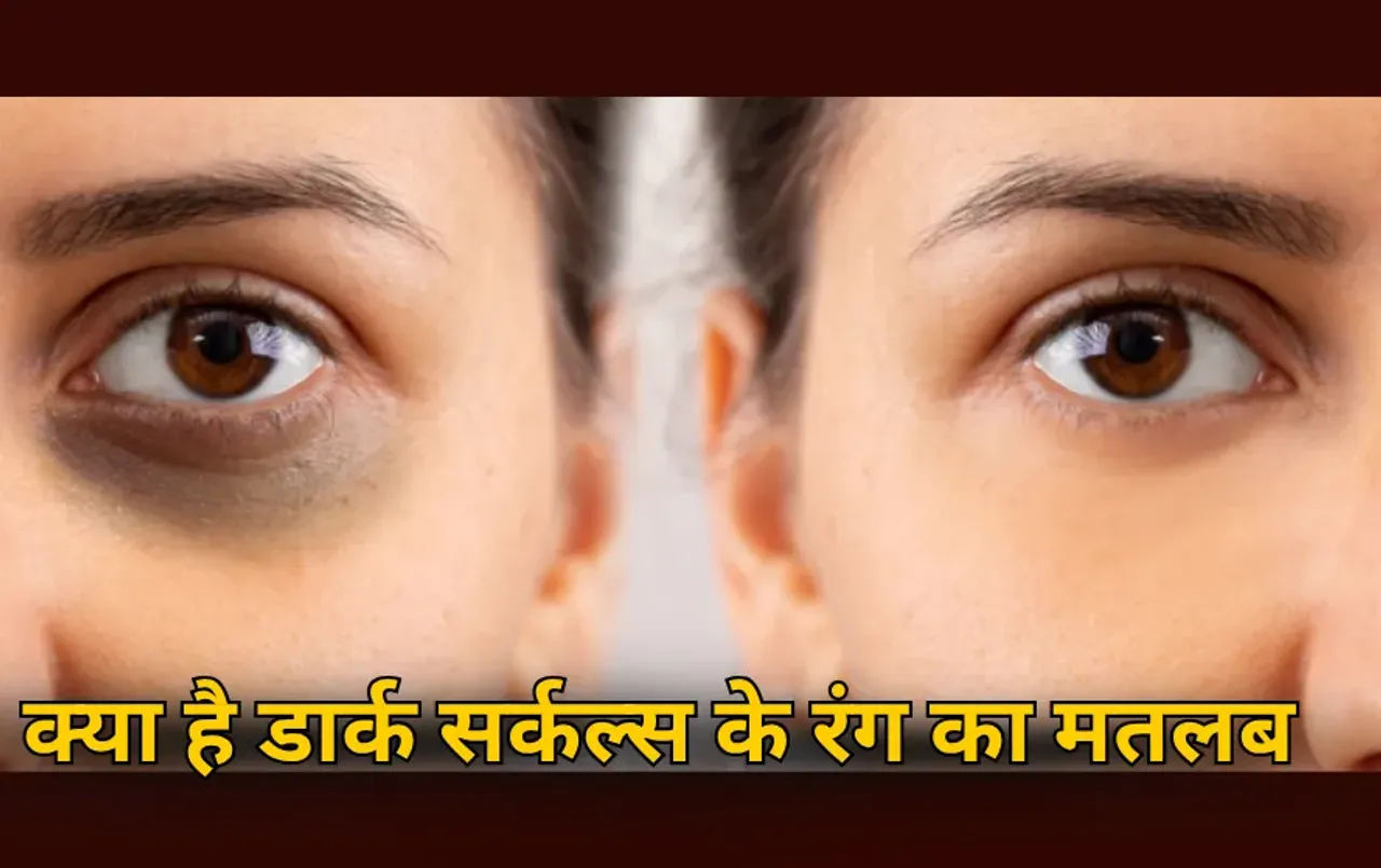 Dark Circles Types Treatment Tips: आंखों के नीचे क्यों होते हैं नीले और ब्राउन घेरे ? जानें डार्क सर्कल्स के रंग का मतलब