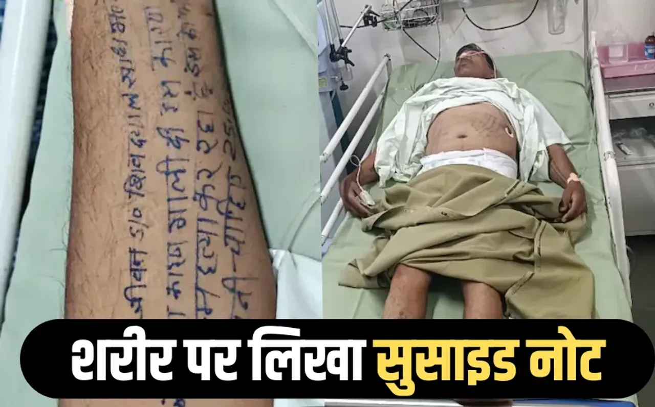 नर्मदापुरम में खुदकुशी की कोशिश: हाथ-पैर पर लिखा सुसाइड नोट फिर खाया सल्फास, उपसरपंच पति पर लगाए प्रताड़ना के आरोप