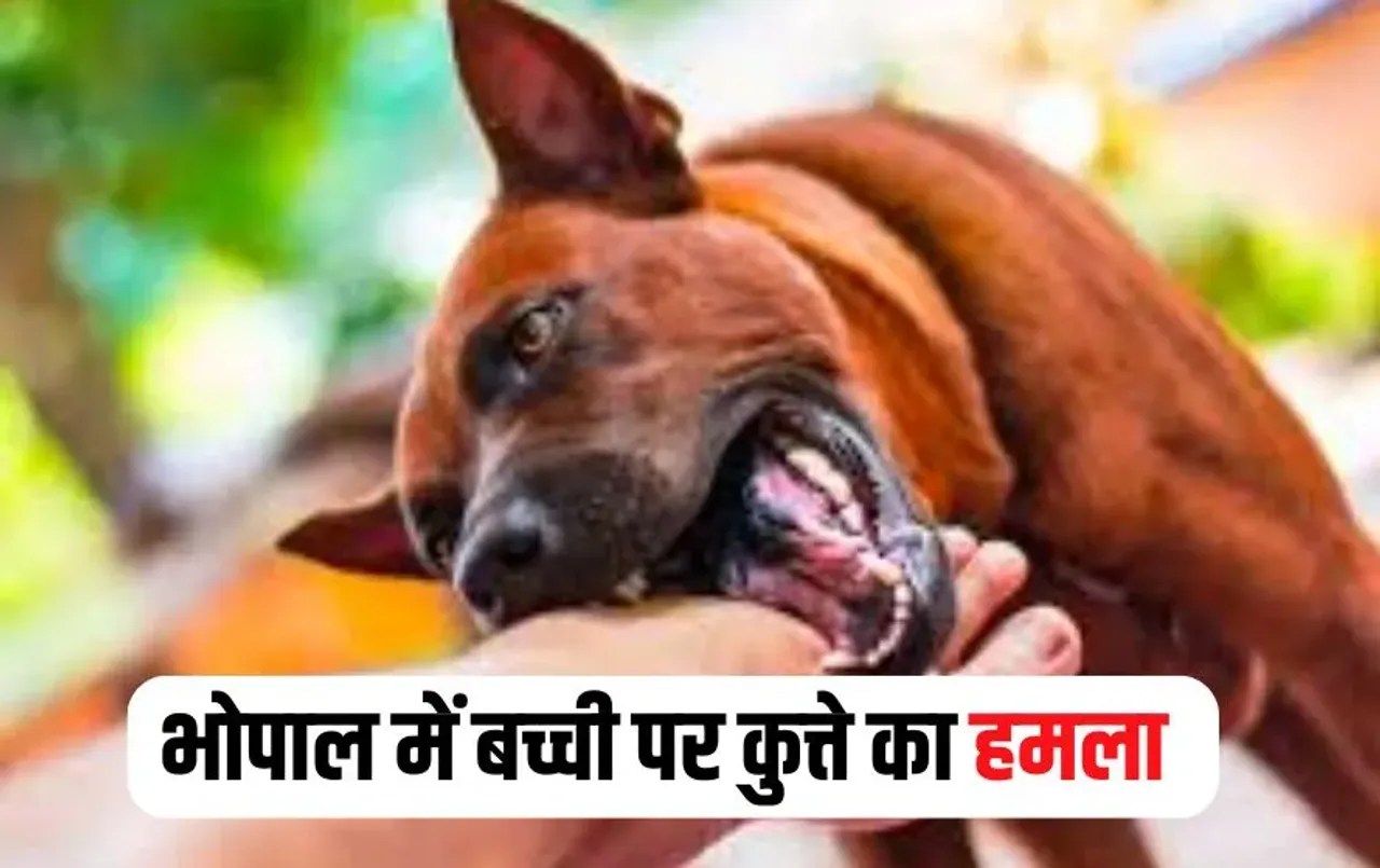 Bhopal Dog Bite Case