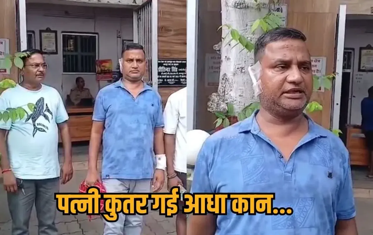 UP kanpur-wife-bites-husband-half-ear-domestic-violence-fir hindi news zxc