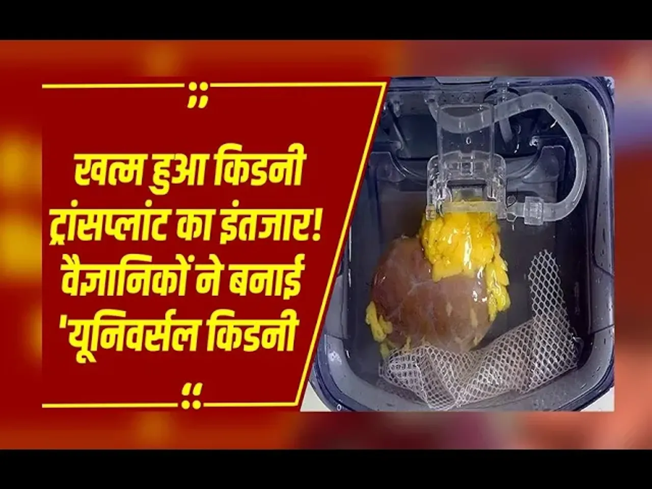Universal Kidney: वैज्ञानिकों ने बनाई यूनिवर्सल किडनी...किसी भी ब्लड ग्रुप को लग सकेगी किडनी