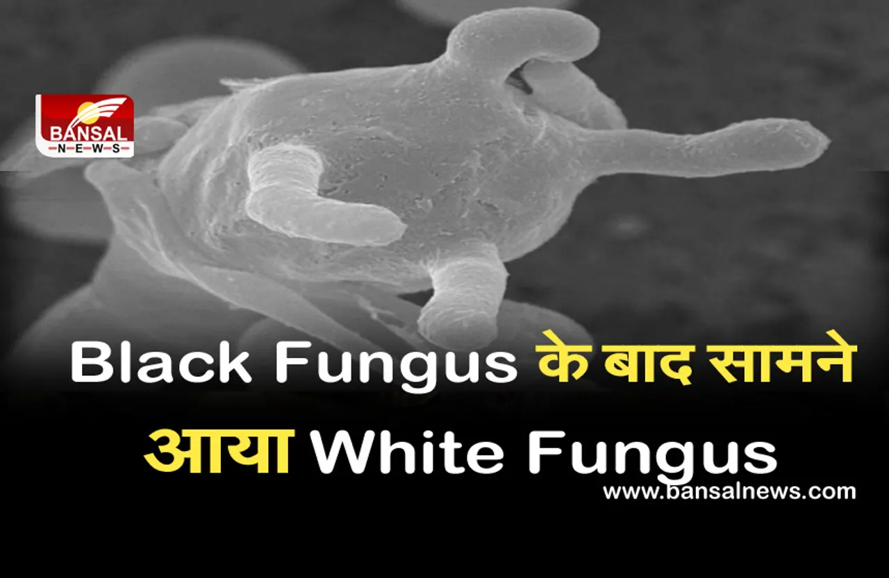 White Fungus: ब्लैक फंगस से ज्यादा खतरनाक है व्हाइट फंगस, जानें कैसे करता है शरीर पर अटैक