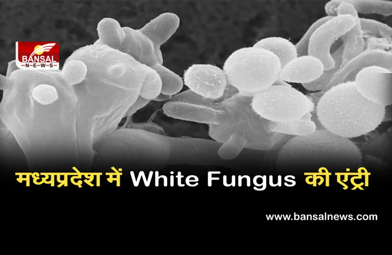 मध्यप्रदेश में अब व्हाइट फंगस की एंट्री, जबलपुर में मिला पहला मामला