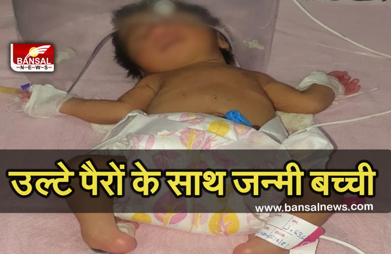 Breaking News: उल्टे पैरों के साथ जन्मी बच्ची, नजारा देख अस्पताल छोड़ भागे माता-पिता
