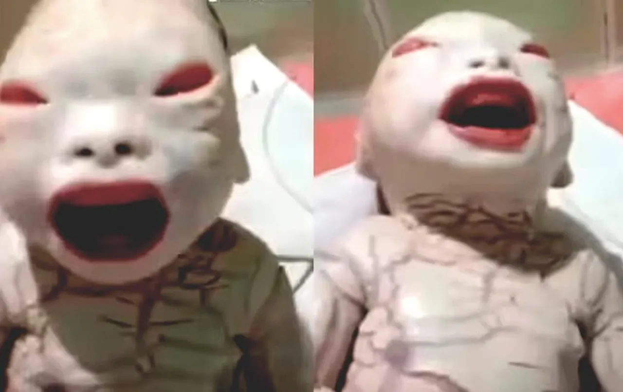Alien Child Birth News: महिला ने एलियन जैसे बच्चे को दिया जन्म, डॉक्टर भी रह गए दंग