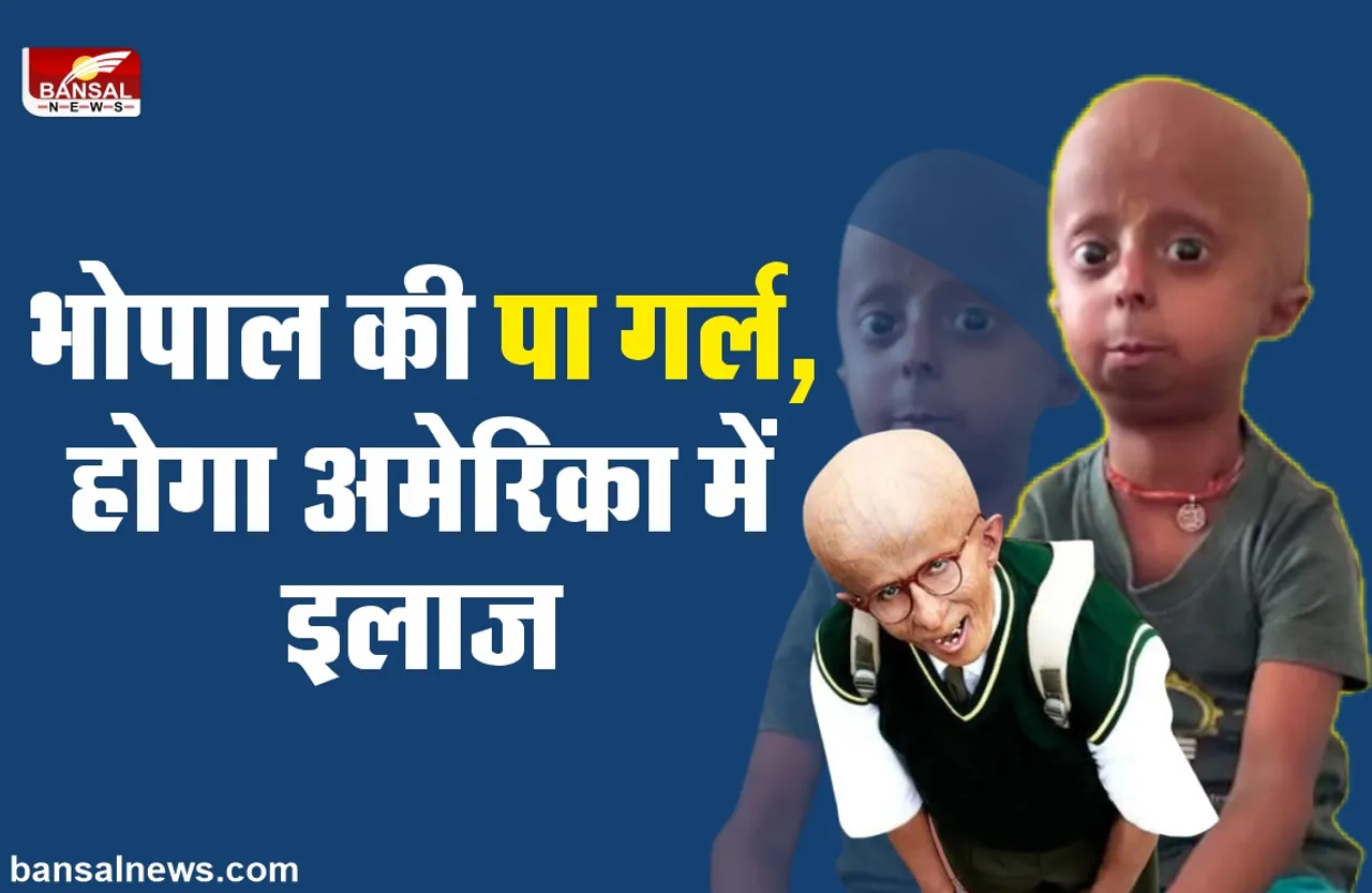 Bhopal Paa Girl : भोपाल में मिली 'पा' वाली बच्ची गुंजन, अब होगा अमेरिका में इलाज