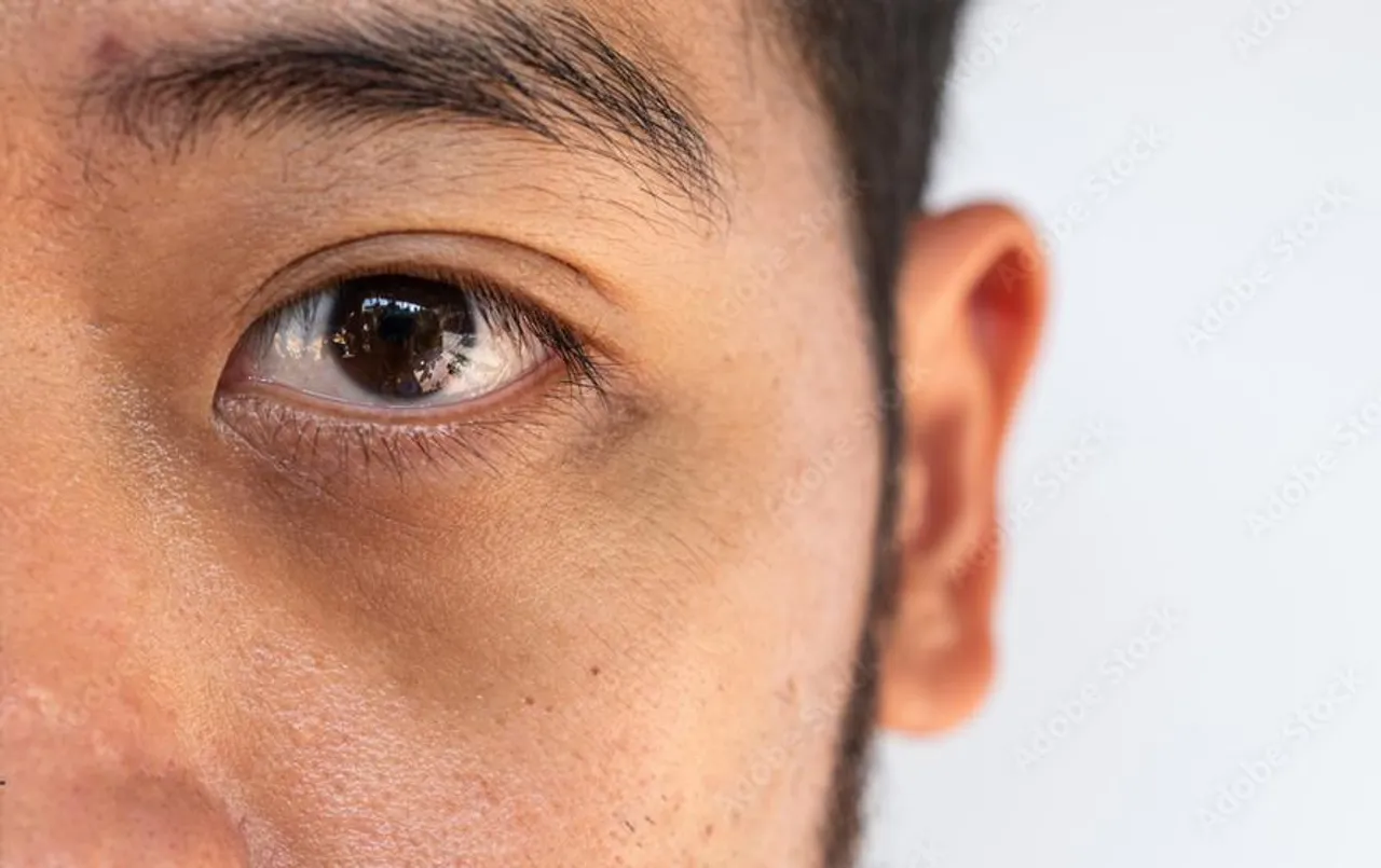 Dark Circles Problem: डार्क सर्कल से है परेशान तो अपनाएं यह घरेलू उपाय..