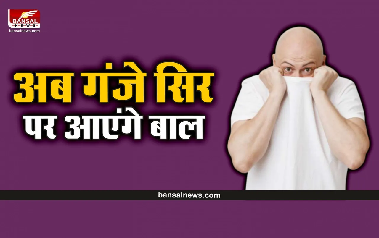 Hair Care Tips : गंजे सि‍र पर भी आएंगे बाल, करें घर की इस चीज का इस्तेमाल