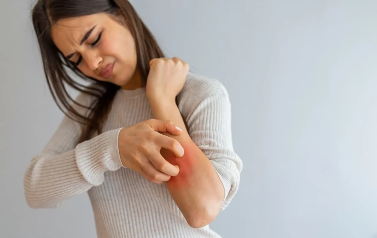 क्या आप गर्मियों में जलन और दर्द से है परेशान, अपनाएं ये खास आसान उपाय