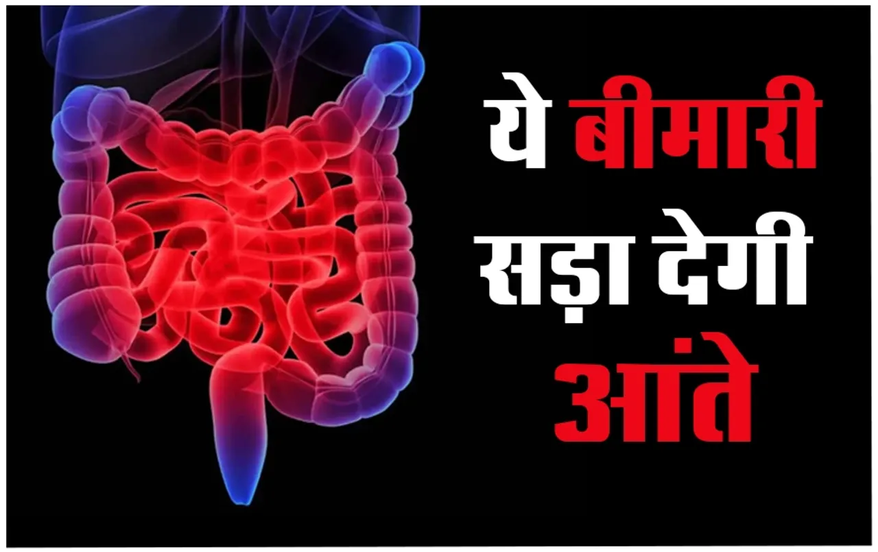 Inflammatory Bowel Disease: लगातार पेट में दर्द बन सकता है खतरनाक बीमारी की वजह, IBD सड़ा सकती है आपकी आंते, जानें बचाव