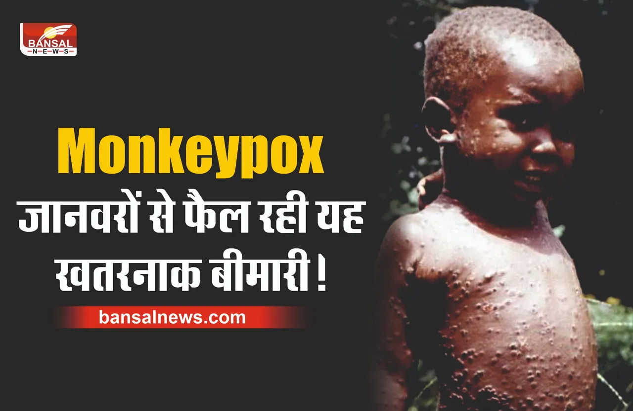 Monkeypox : क्या है मंकी पॉक्स, इन जानवरों से फैल रही यह खतरनाक बीमारी!
