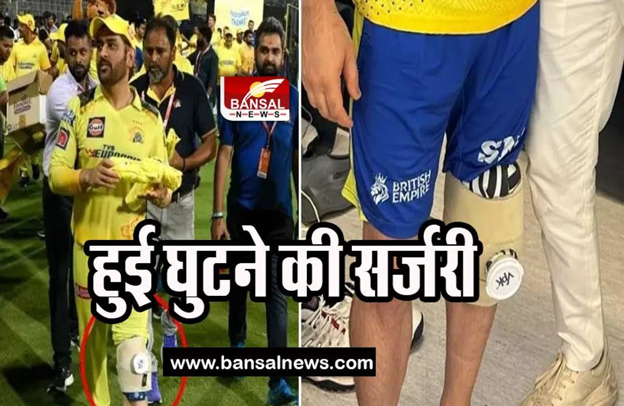 MS Dhoni Surgery: आज कोकिलाबेन अस्पताल में होगी धोनी की सर्जरी, IPLके पहले मैच में हो गए थे चोटिल
