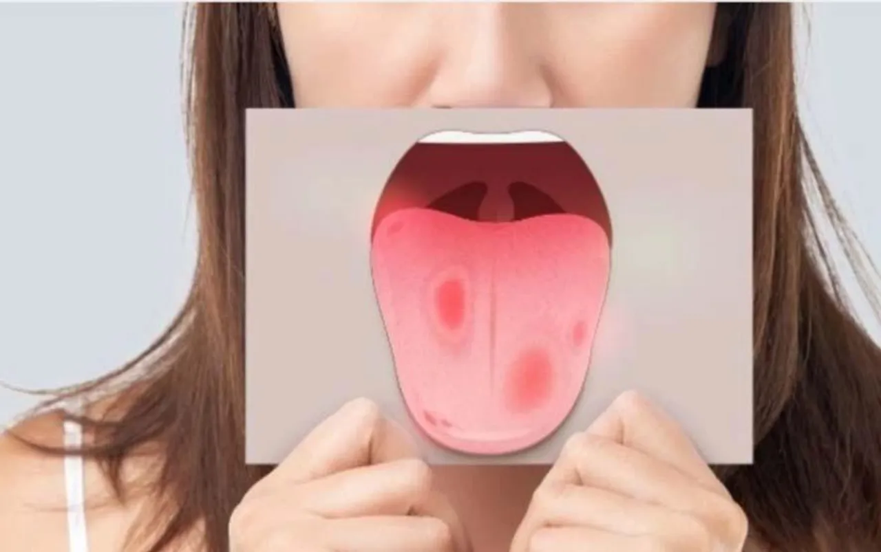 Tongue Cleaning Tips: गंदी जीभ दे सकती हैं गंभीर बीमारियां. ऐसे करें अपने जीभ की सफाई