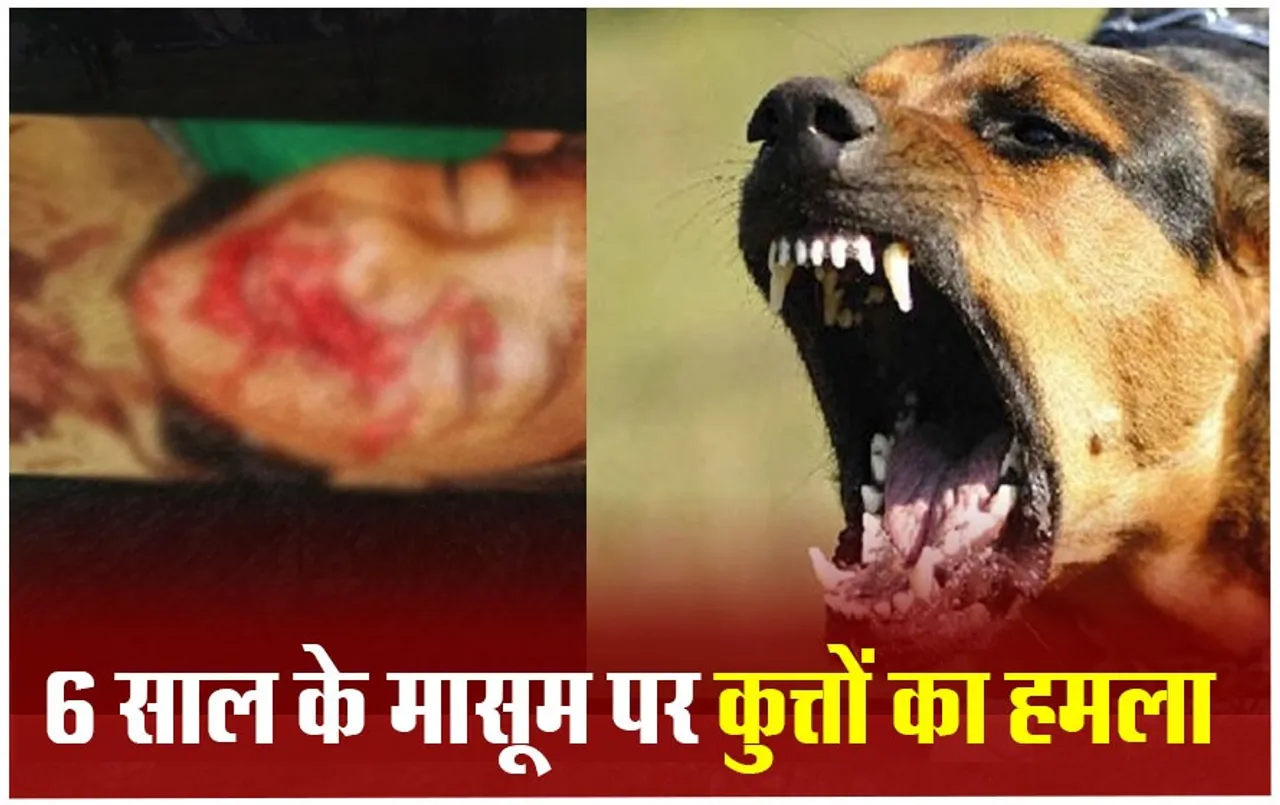Bhopal Dog Attack: हिंसक कुत्तों ने‌ फिर मासूम ‌को किया लहूलुहान,‌‌ सड़क पर खेलते समय कुत्तों ने बोला हमला
