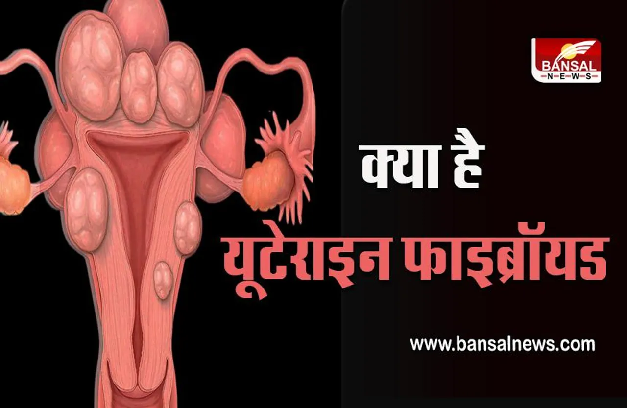 Uterine Fibroid : आखिर क्या है यूटेराइन फाइब्रॉयड, आप भी जान लें लक्षण और उपाय